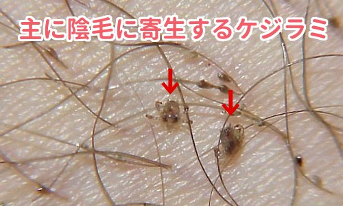 コレって性病の症状！？と不安な女性のためのサイト